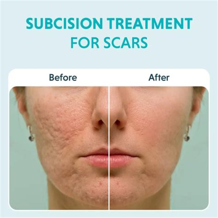 Unveiling The Scars And Triumphs